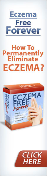 Eczema Free You