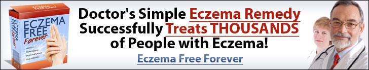 Eczema Free You