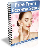 Free From Eczema Scars