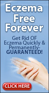 Eczema Free You